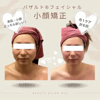 35歳からの エイジングケアサロンのエステ・リラクイメージ