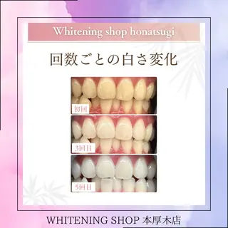 メンズ ホワイトニング ショップ本厚木のその他イメージ