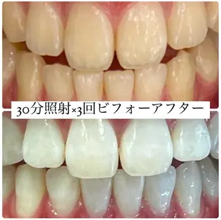 ホワイトニングルーム 横浜店のその他イメージ