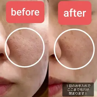 Noguchi staffのエステ・リラクイメージ