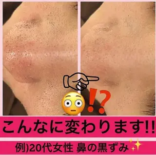 ミディアム カラー パーマ ヘアアレンジ メンズ キッズ ネイル マツエク・マツパ ニキビ・肌質改善専門 ♡人生が変わるサロンのエステ・リラクイメージ