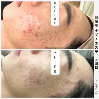 メンズ Rappore; 心斎橋　みずきのエステ・リラクイメージ