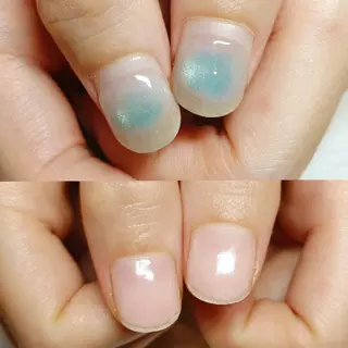 ネイル 深爪矯正/爪育成ケア manie nailのネイルデザイン