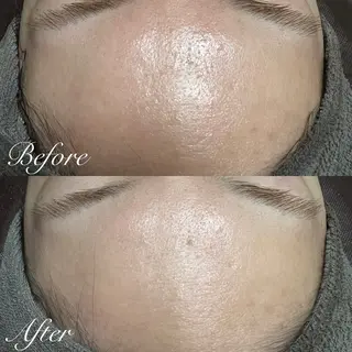 シミ🩷ニキビ専門店 Matteo🎀✨のエステ・リラクイメージ