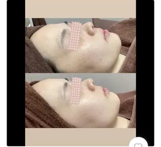 💫Linola💫 レイビス　小林のエステ・リラクイメージ