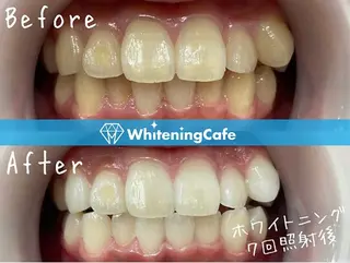 ホワイトニングカフェ 荻窪店のその他イメージ