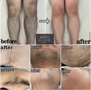 脱毛専門サロン Elixir　加須店のエステ・リラクイメージ