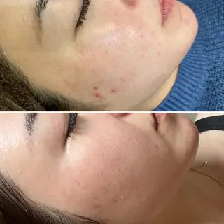 Lash Connect 石川のマツエク・マツパデザイン