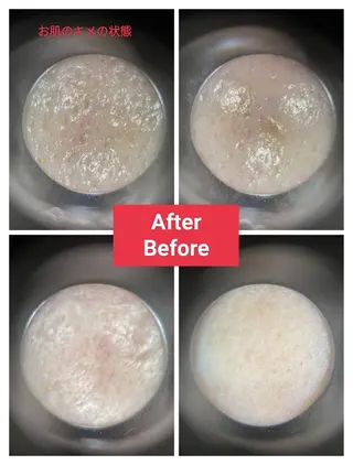 beauty salon mewのエステ・リラクイメージ