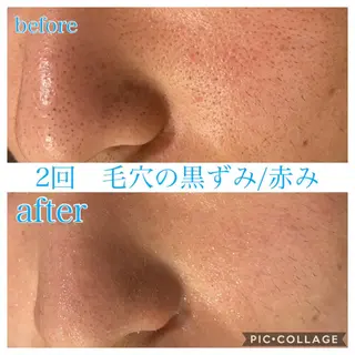 ロング カラー パーマ ヘアアレンジ キッズ ネイル マツエク・マツパ EnsorClair 代表 野口真央のエステ・リラクイメージ