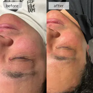 エステサロン Venusのその他イメージ