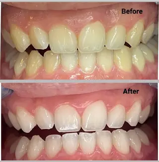 アイラッシュサロン ミノのマツエク・マツパデザイン