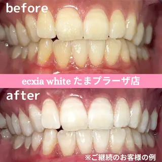 セルフホワイトニング　エクシアたまプラーザ店所属・yukari - オーナー -のその他イメージ