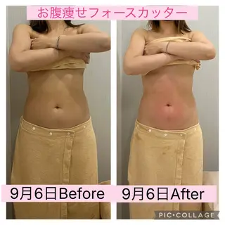 ブライダル痩身×脱毛 尼崎駅前サロンのエステ・リラクイメージ