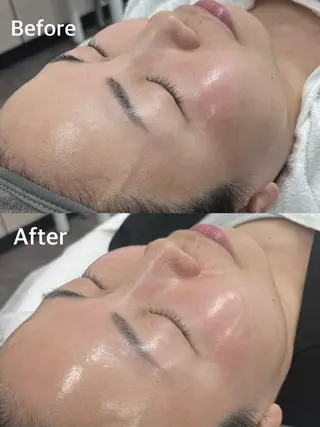 小顔専門看護師クリニカルサロンCOCO所属・小顔と美肌サロン クリニカルサロンココのエステ・リラクイメージ