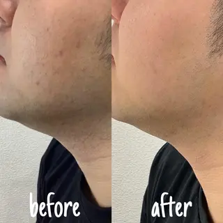 メンズ Diar salon もものエステ・リラクイメージ