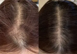 【福岡市西区 エステ】 GRANVIR(グランヴィール)所属・GRANVIR グランヴィールのエステ・リラクイメージ