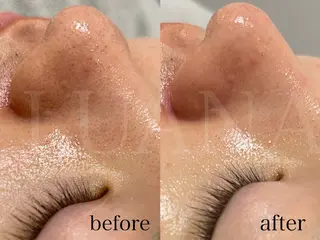 メンズ LUANA TAKAGIの眉毛・アイブロウイメージ