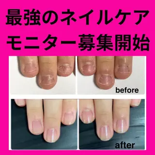 ネイル センター南 eclatのネイルデザイン