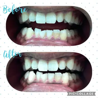 セルフホワイトニング COCOSHIROのエステ・リラクイメージ