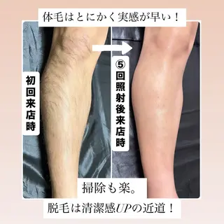 メンズ メンズ脱毛サロン Le falcoのエステ・リラクイメージ