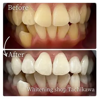 セルフ　ホワイト ニングショップ立川のその他イメージ