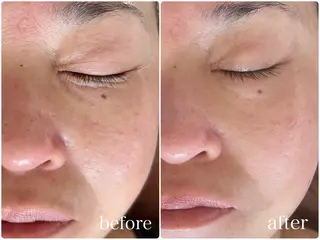 beauty salon Belle所属・Belle【ベル】 YUKA⸜🌷︎⸝のエステ・リラクイメージ