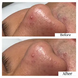 Hémireve Shirokane所属・トロイアルケ🩵 美眉EMIの眉毛・アイブロウイメージ