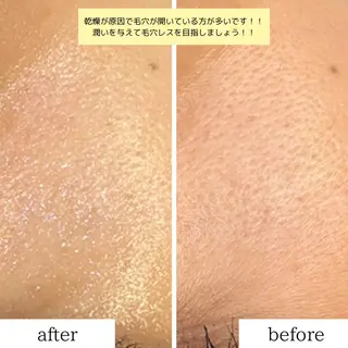 leolo武蔵浦和 肌質改善&脱毛のエステ・リラクイメージ