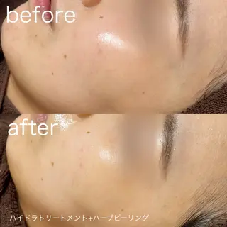 lulularico Yuのエステ・リラクイメージ