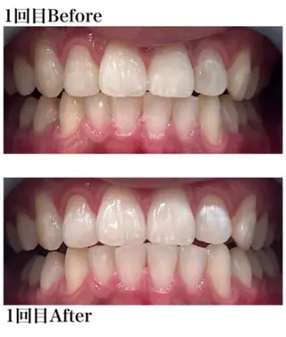 ホワイトニング ショップ津店のその他イメージ