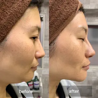 美肌，美ボディ，脱毛 サクラチャンスパのエステ・リラクイメージ