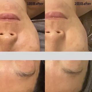 DUPE&MORE 店長kanaeのエステ・リラクイメージ