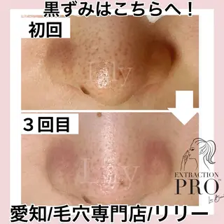 トータルビューティー サロンLilyのエステ・リラクイメージ