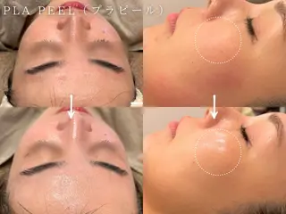 癒し&美活サロン COALALU麻布のエステ・リラクイメージ