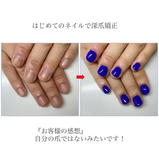 ネイル ネイルサロン アリュームのネイルデザイン