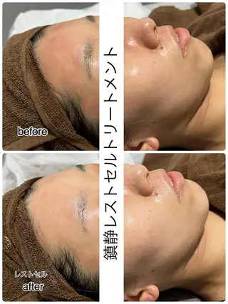 ENCHANT 脱毛.小顔.毛穴のエステ・リラクイメージ