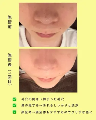 Cheerful所属・肌メンテ専門 /Cheerfulのエステ・リラクイメージ