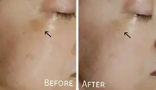 ICHOOSE/ 代々木上原のエステ・リラクイメージ