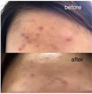 esthesalon O'-en-のエステ・リラクイメージ
