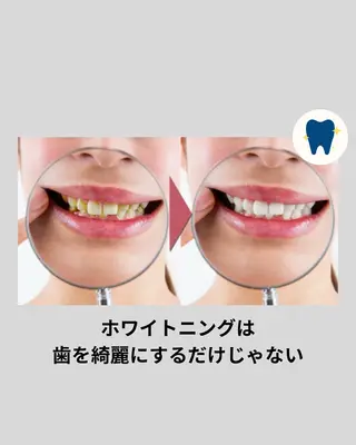 ホワイトニングショップ津店所属・ホワイトニング ショップ津店のその他イメージ