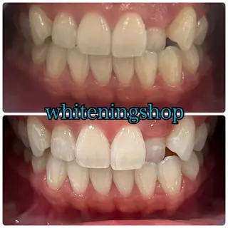 ホワイトニング ショップ津店のその他イメージ