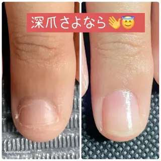 ネイル 奥園 良恵のネイルデザイン