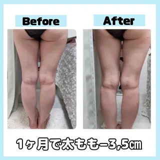 オールハンド専門🤍 痩身/小顔/ ハーブのエステ・リラクイメージ