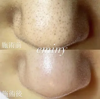EMINY （エステティシャン）のエステ・リラクイメージ