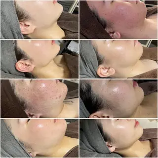 Beautysalon.aise所属・横田 美悠のエステ・リラクイメージ