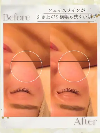 小顔リフトアップ専門 サロン／ダリア 大分のエステ・リラクイメージ