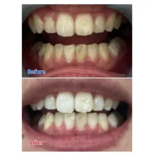 Ｍ渋谷 ホワイトニングのエステ・リラクイメージ