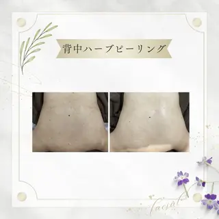 《 肌質×美肌 》 addissimoのエステ・リラクイメージ