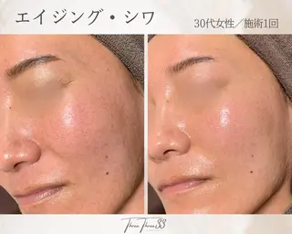 ピーリング×肌管理 THREETHREEのエステ・リラクイメージ